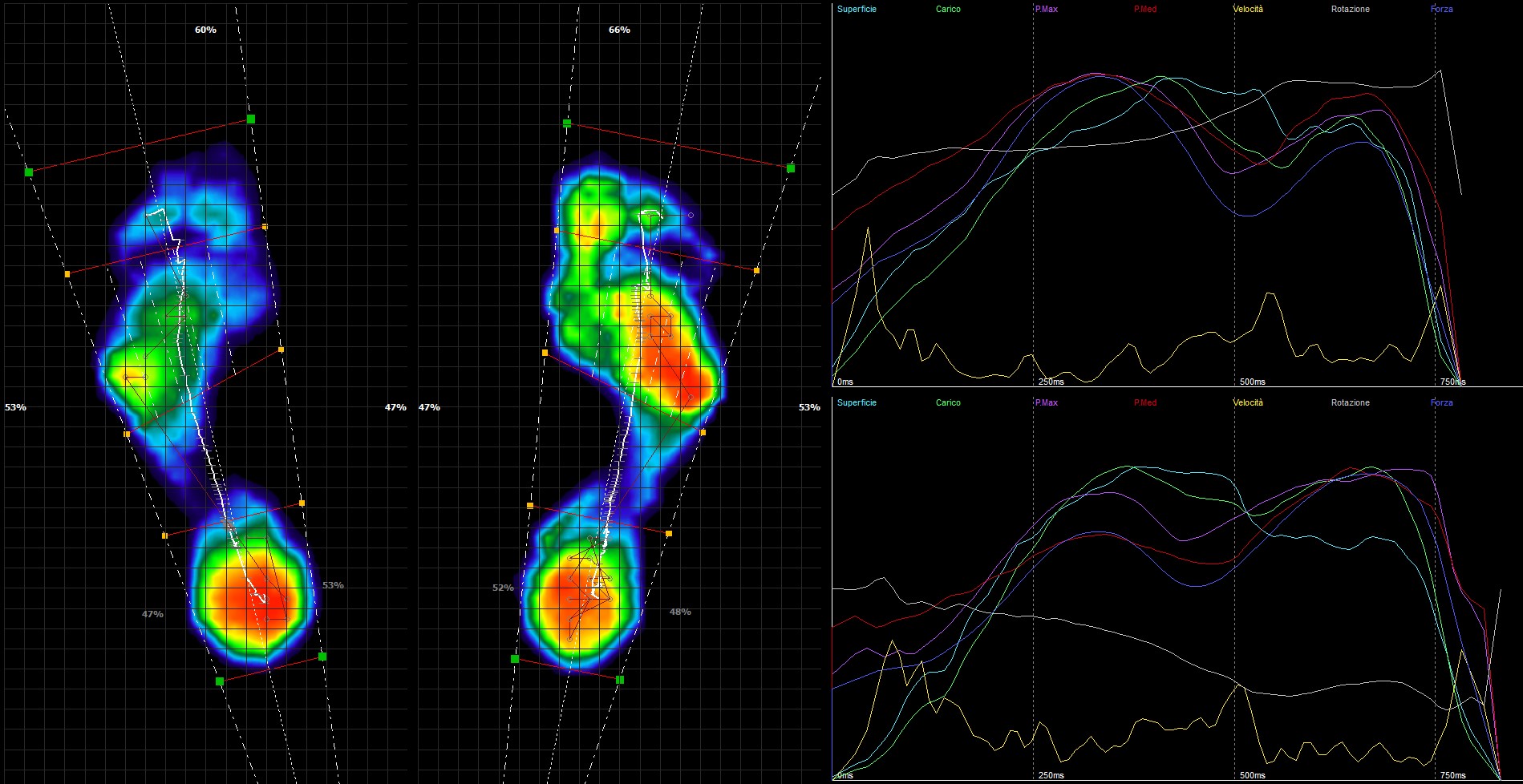 Analisi Baropodometrica